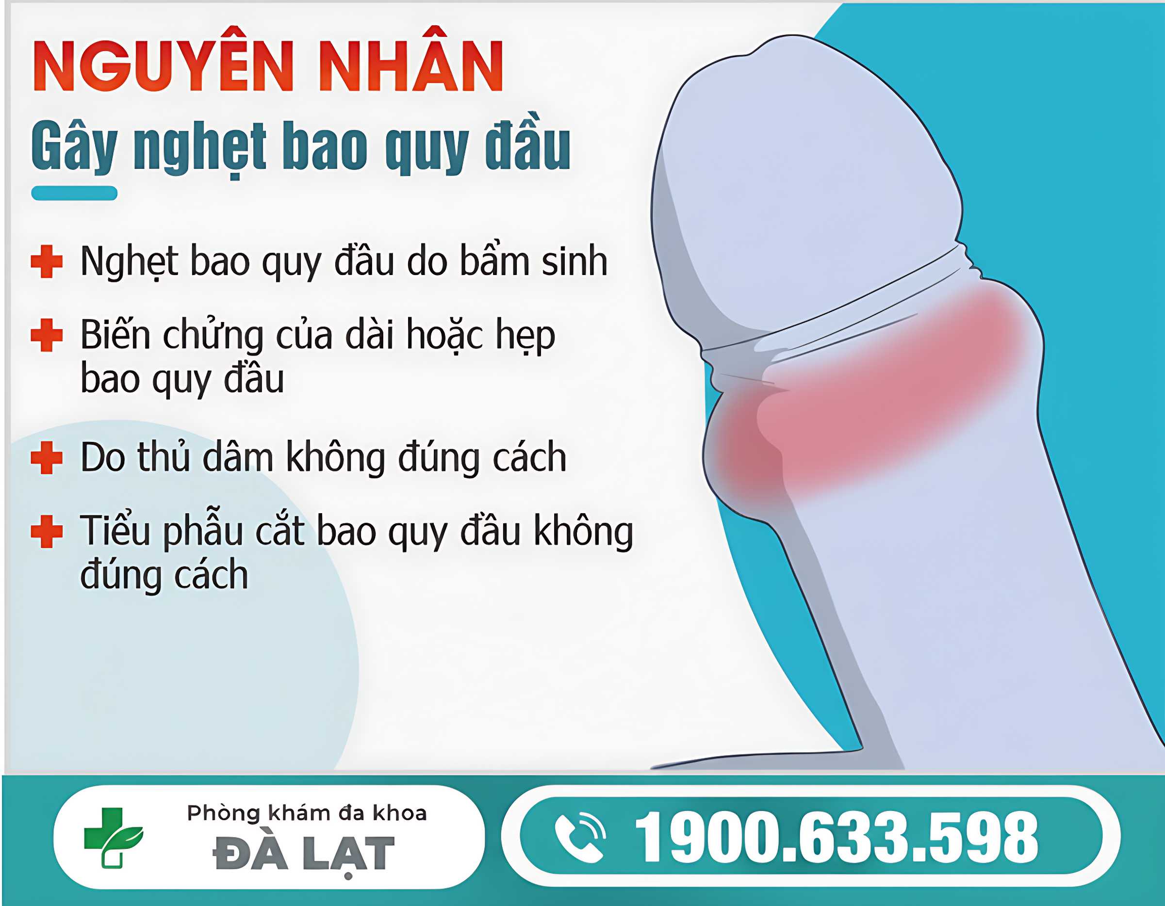 Hình ảnh minh họa